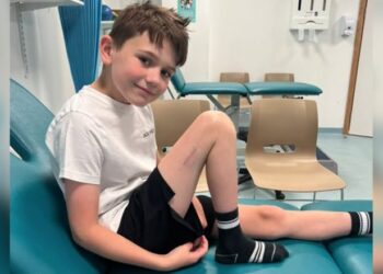 Revolucion në mjekësi/ 9-vjeçari në Britani bëhet fëmija i parë që iu nënshtrua një operacioni për zgjatjen e këmbës