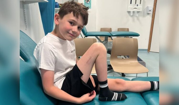 Revolucion në mjekësi/ 9-vjeçari në Britani bëhet fëmija i parë që iu nënshtrua një operacioni për zgjatjen e këmbës